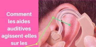 Quand les prothèses auditives soulagent les patients acouphéniques.