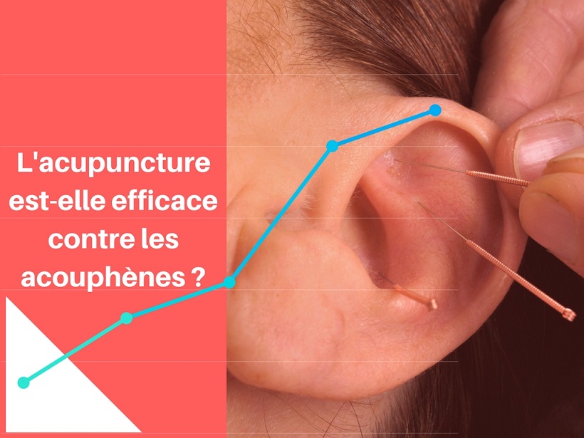 L'acupuncture est-elle efficace contre les acouphènes ? - Traiter