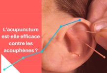 Comment l'acupuncture, par son approche holistique, permet de soulager les patients acouphéniques.