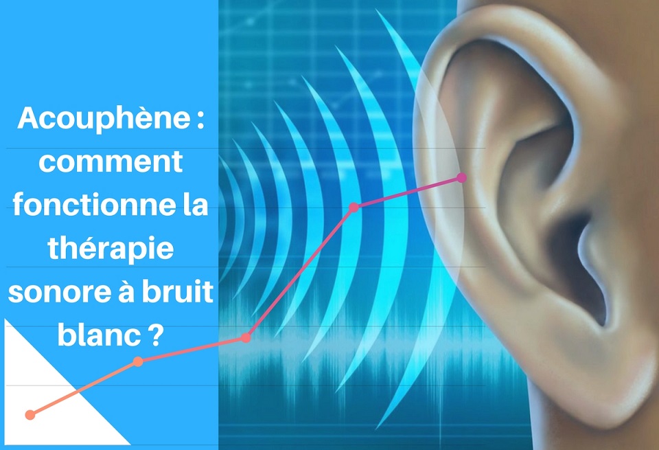 Acouphène : comment fonctionne la thérapie sonore à bruit blanc ? 