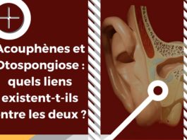 Otospongiose et acouphènes : quand une pathologie causale créé des symptômes acouphéniques.