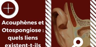 Otospongiose et acouphènes : quand une pathologie causale créé des symptômes acouphéniques.