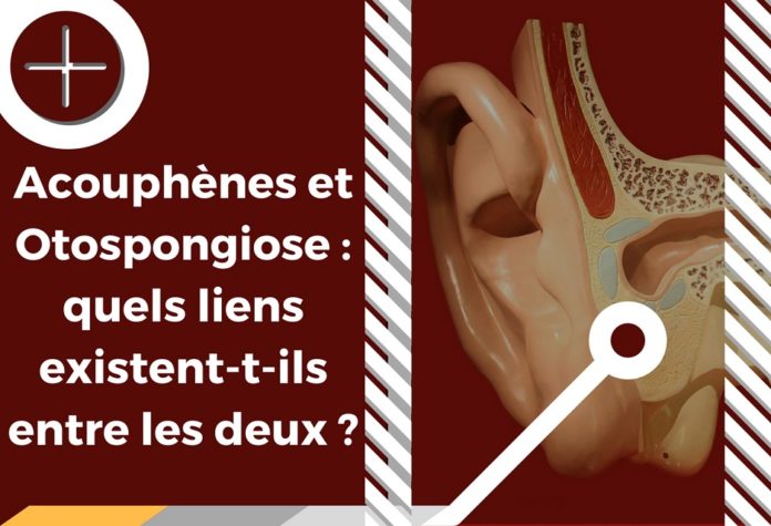 Otospongiose et acouphènes : quand une pathologie causale créé des symptômes acouphéniques.