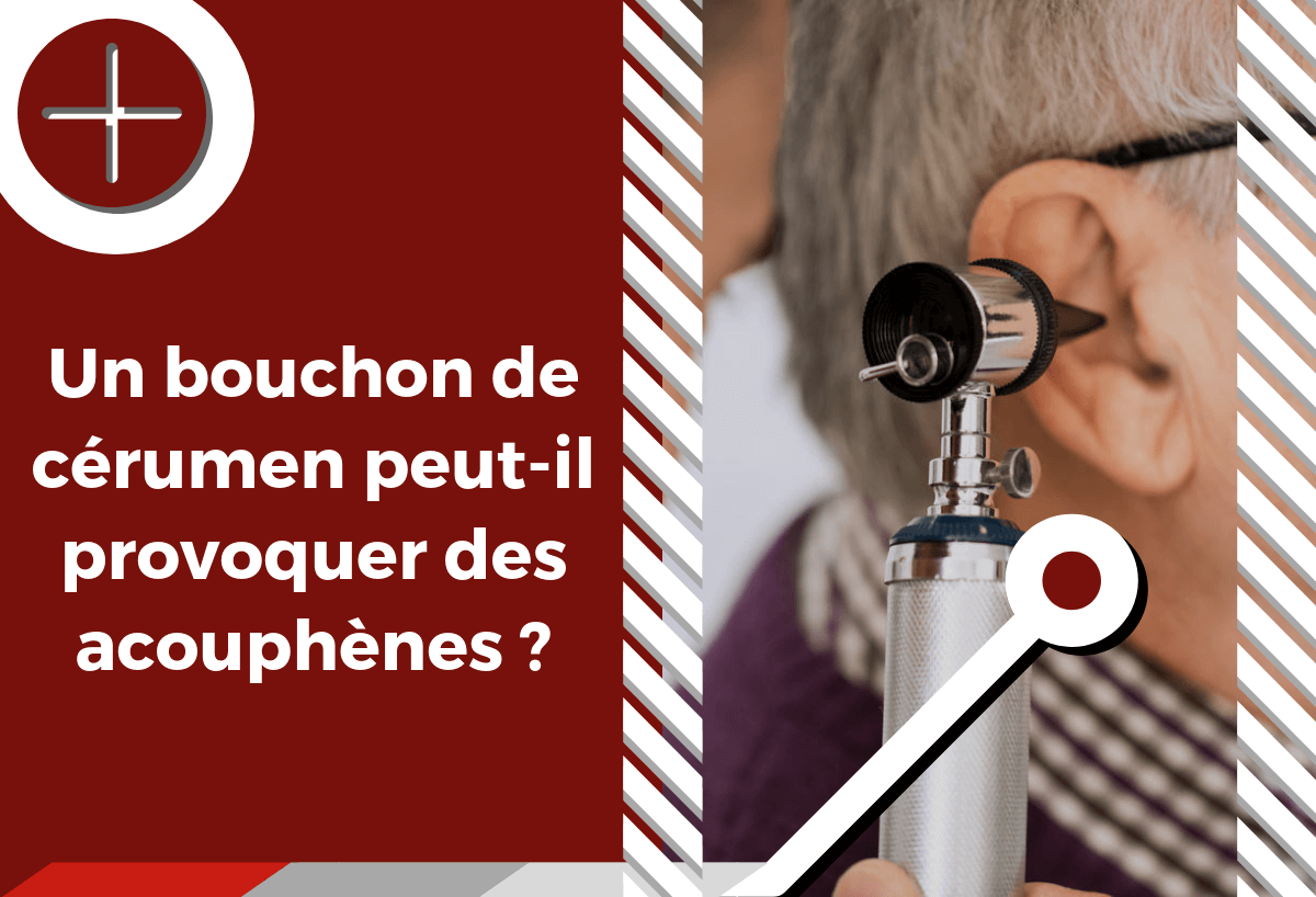 Un bouchon de cérumen peut-il provoquer des acouphènes ? 