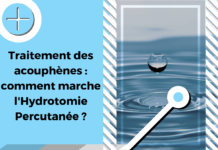 Cette image illustre l'hydrotomie percutanée dans le cadre du traitement des acouphènes