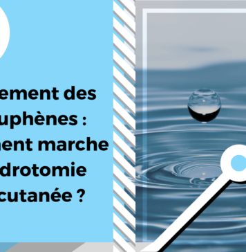 Cette image illustre l'hydrotomie percutanée dans le cadre du traitement des acouphènes