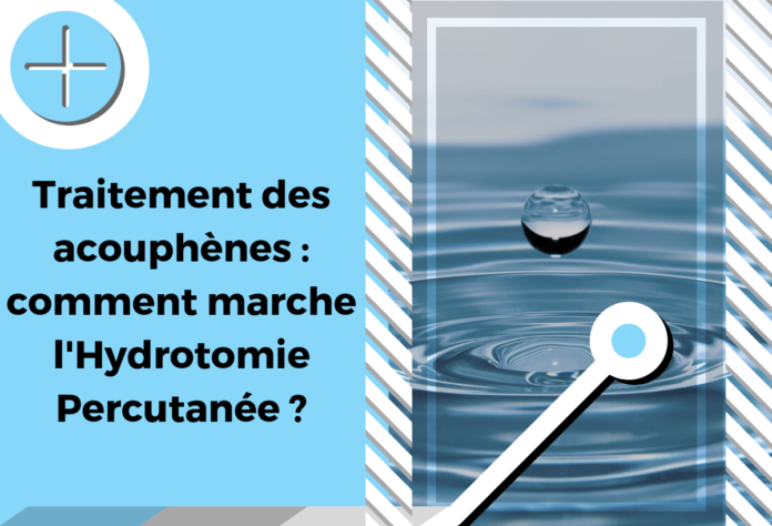 Cette image illustre l'hydrotomie percutanée dans le cadre du traitement des acouphènes